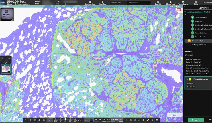 Indica Labs announces launch of AI-powered Macrodissection Suite