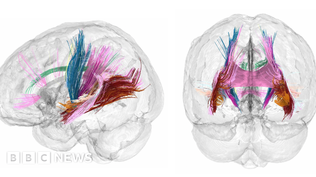 Brain changes during pregnancy revealed in detailed map