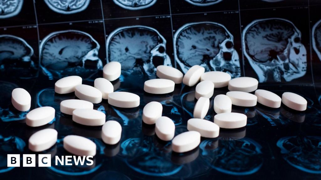 NHS will not fund new drug to slow Alzheimer’s