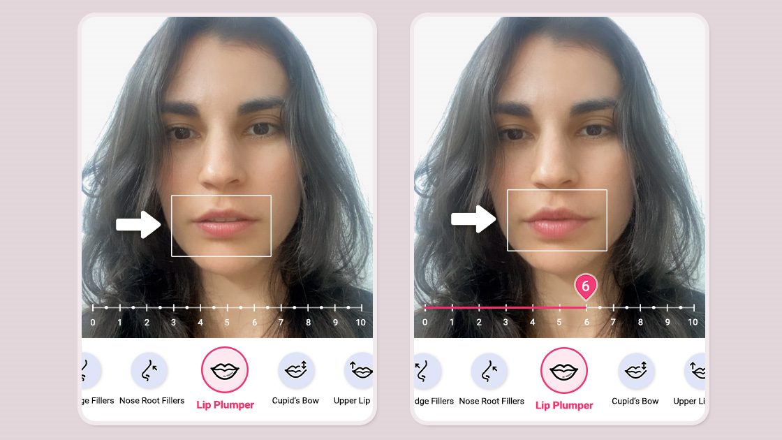 Enhancing Cosmetic Treatment Conversions with Advanced AI Simulation Technology